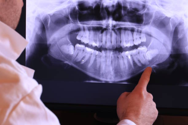 Best Broken or Cracked Tooth Emergency Dentist in Cody, WY