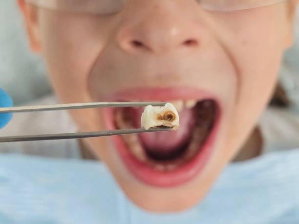 Best Weekend Emergency Dentist in Cody, WY