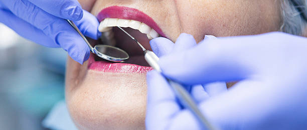 Best Emergency Dental Care for Abscessed Tooth in Cody, WY